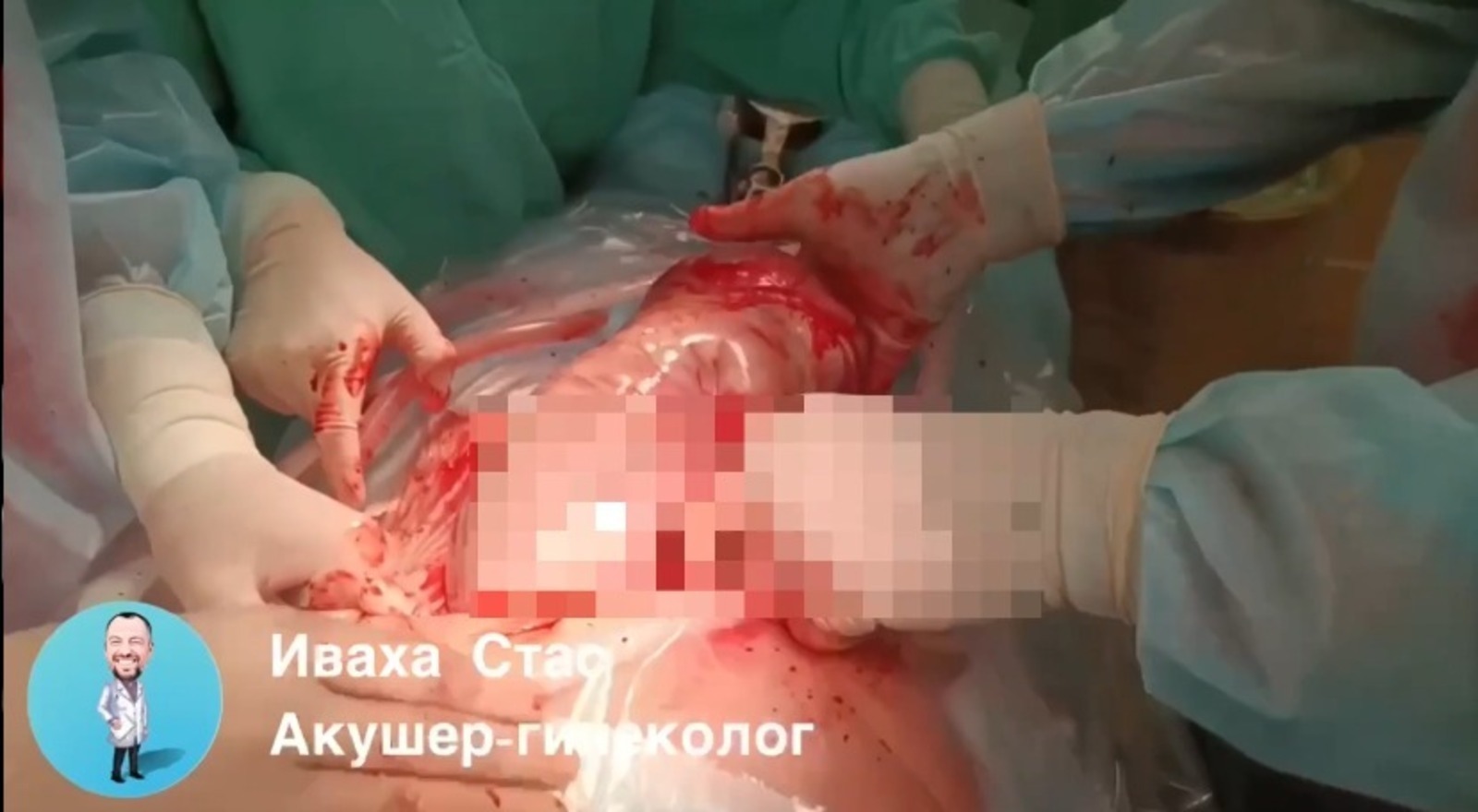 Өфөлә ҡыҙ бала бөркәнсек менән тыуған